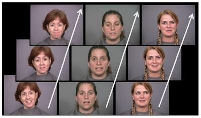 Developmental Prosopagnosia and Elastic Versus Static Face Recognition in an Incidental Learning Task